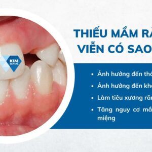Mầm răng - Bí mật phát triển răng miệng